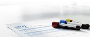 Test results and chart